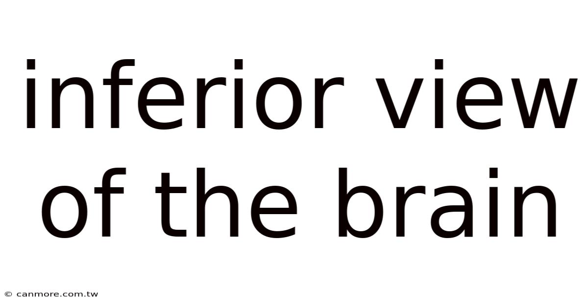 Inferior View Of The Brain